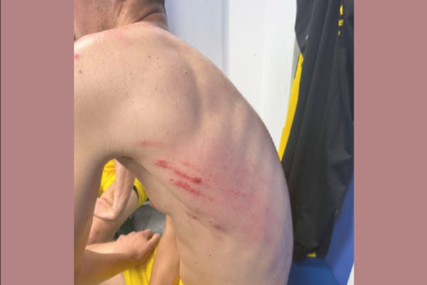 Lojtari i Besës së Pejës lëndohet rëndë në ndeshjen me Dinamon, klubi paralajmëron ankesë.