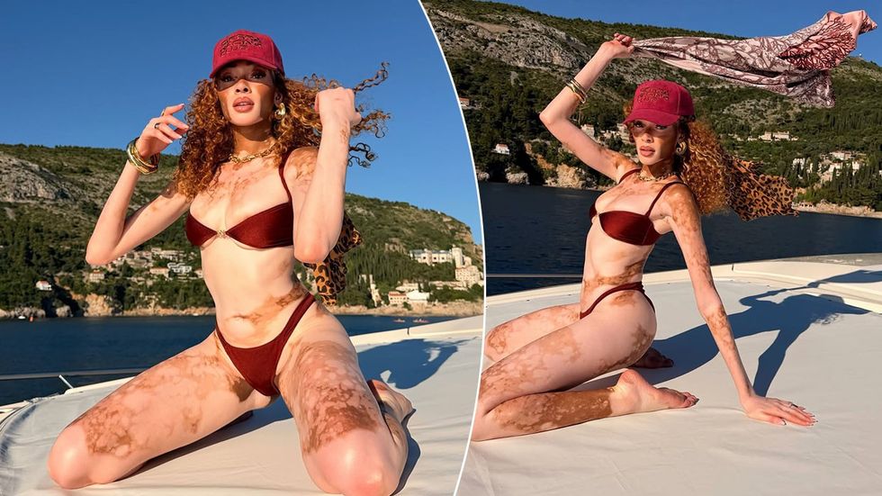 Winnie Harlow shijon pushimet në Dubrovnik duke treguar bukurinë unike të lëkurës së saj