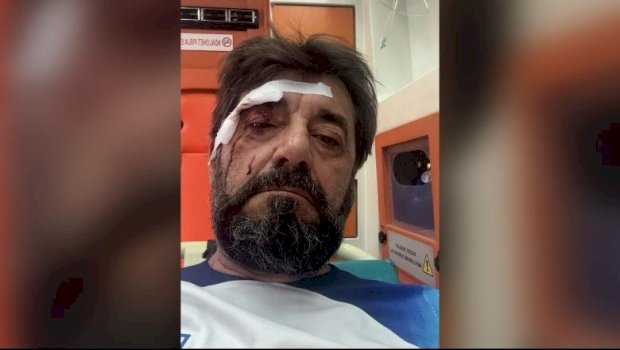 Policia ka identifikuar dhe shpallur në kërkim autorin kryesor të sulmit ndaj Ilir Demaliajt.