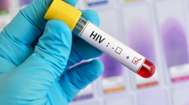 Rritet numri i rasteve me HIV/AIDS në Kosovë gjatë 2026