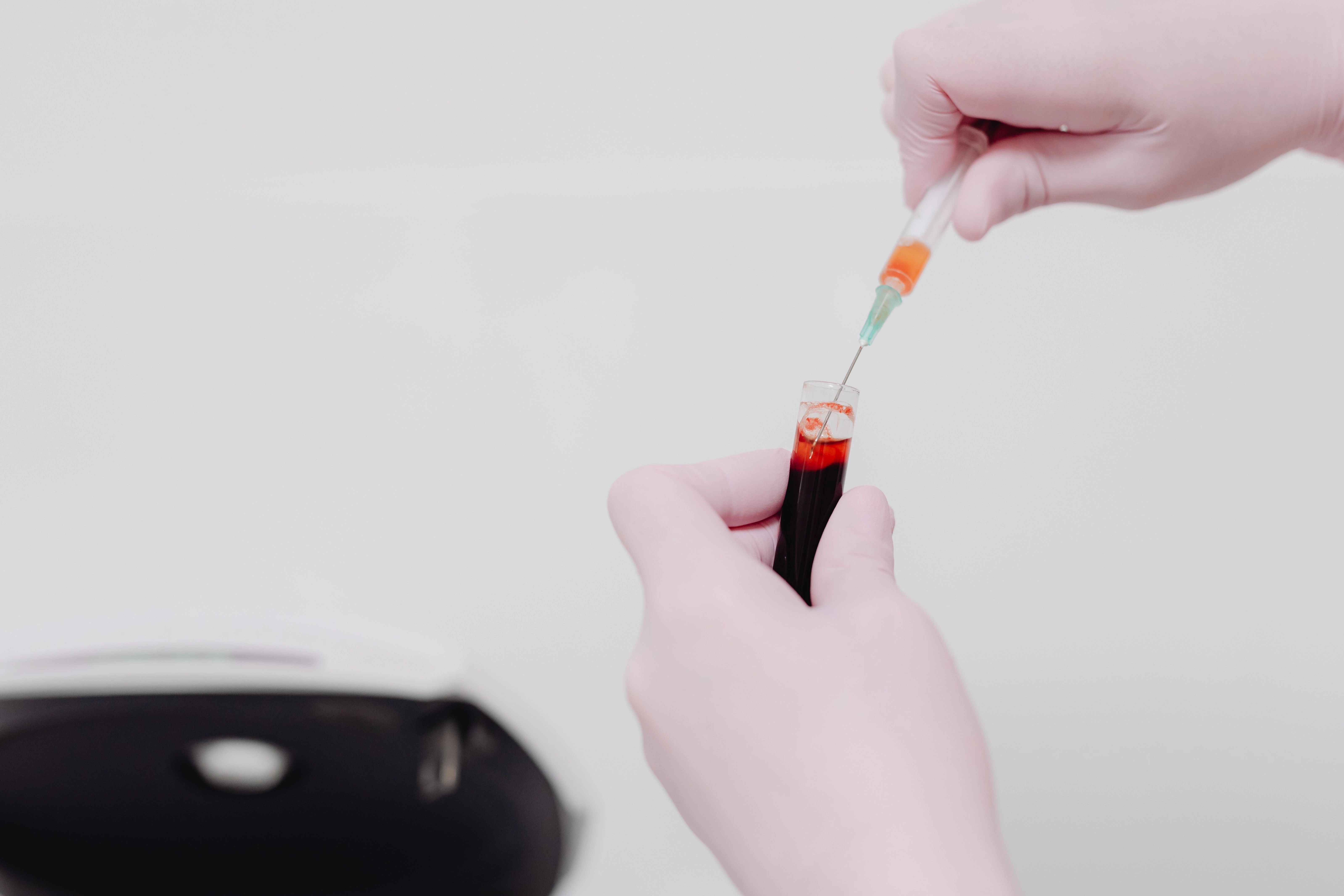 Anglia në prag të eliminimit të hepatitit C me trajtime revolucionare