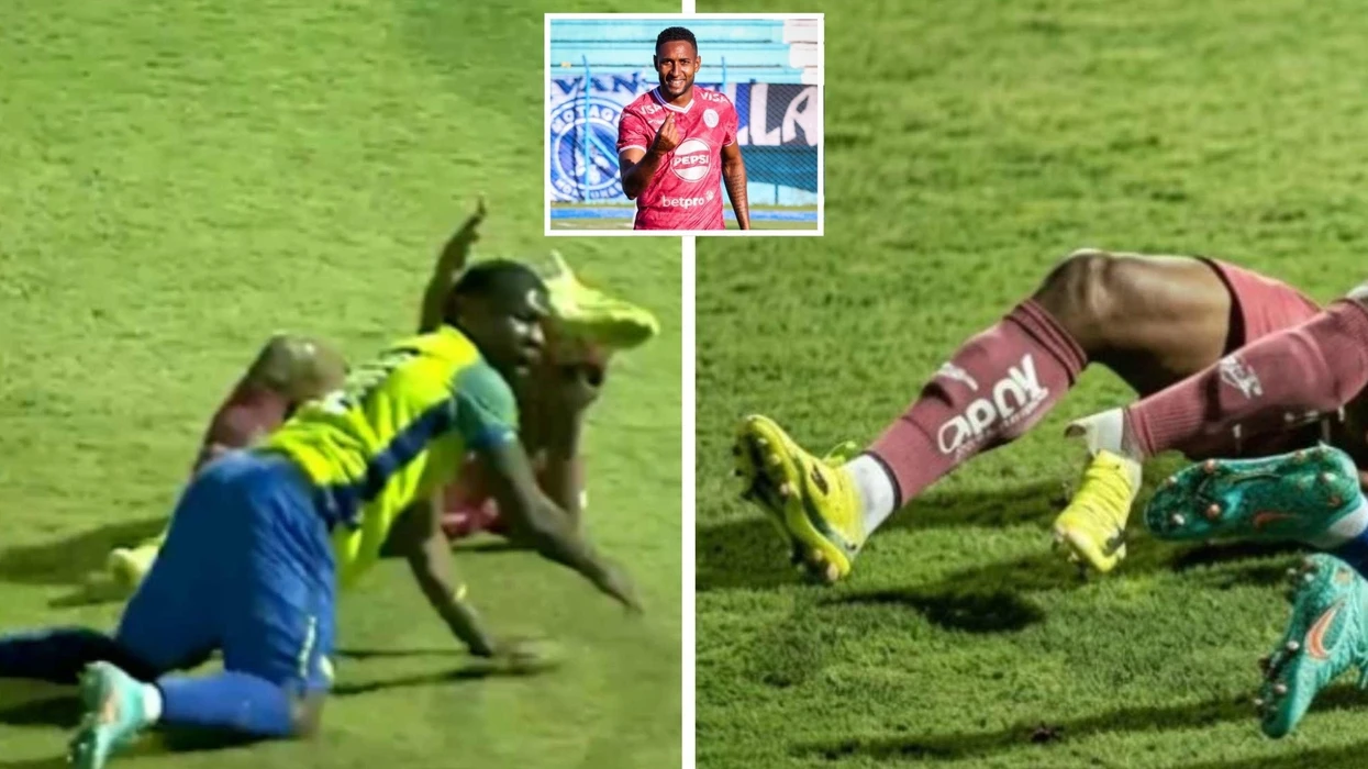 Lëndimi i tmerrshëm i futbollistit brazilian që tronditi ndeshjen në Honduras