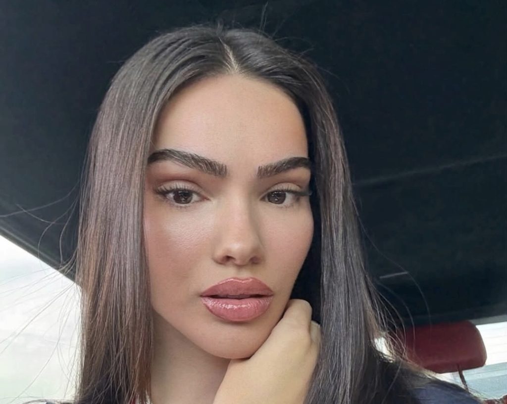 Arbenita Ismajli mahnit me paraqitjen e fundit në Instagram