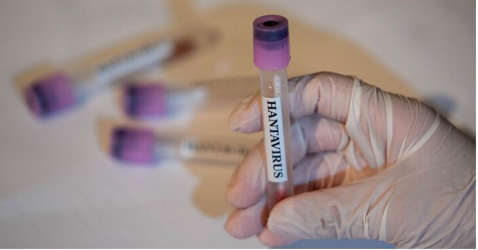 12 punonjës spitali në Holandë në karantinë pas shkeljes së protokolleve për hantavirusin