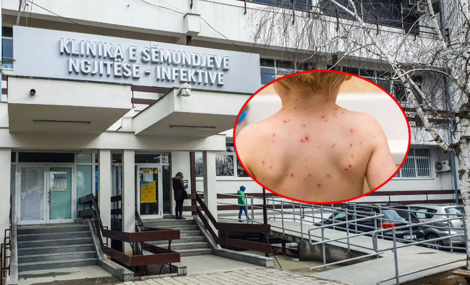 Vetëm nga prilli në Qendrat e Mjekësisë Familjare në Prishtinë janë vaksinuar mbi 200 fëmijë.