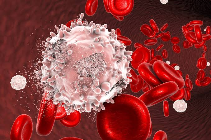 Në vendin tonë diagnostikohen çdo vit më shumë se 33 mijë raste të tumoreve të gjakut.