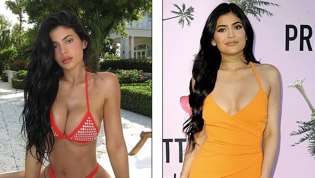 Kylie Jenner ndez rrjetin me fustanin e zi dhe dëshirën për implante më të mëdha