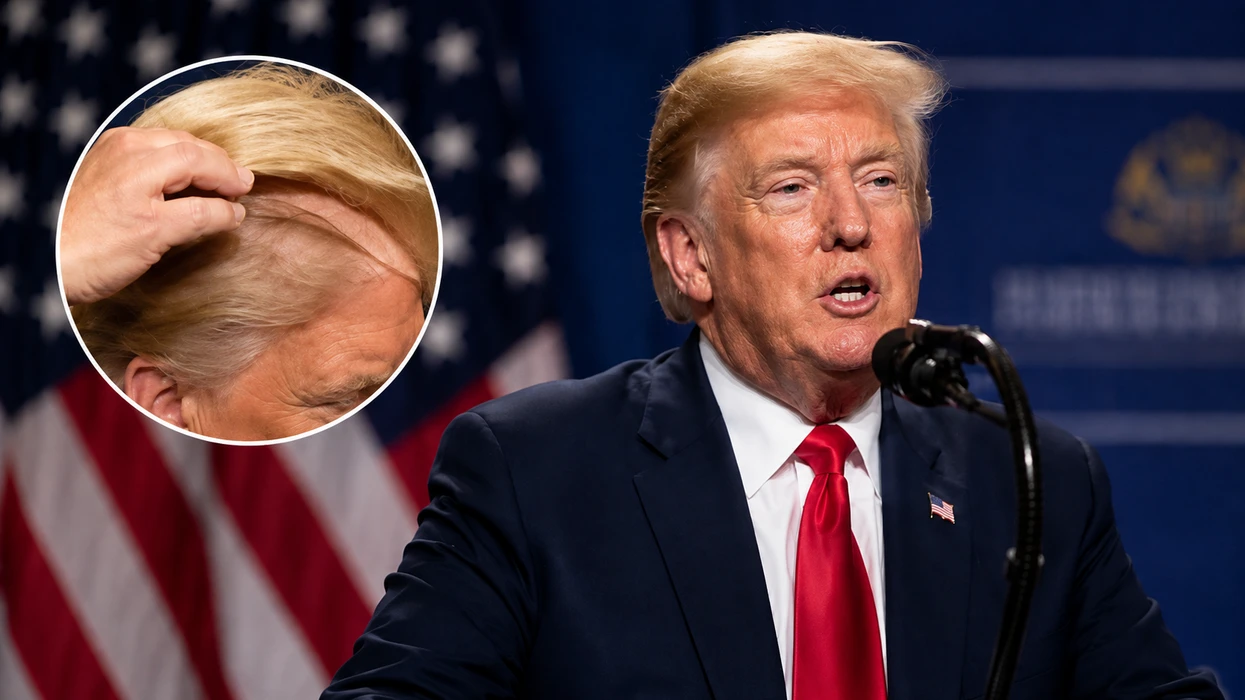 Trump dhe misteri i flokëve: A është paruke apo jo?