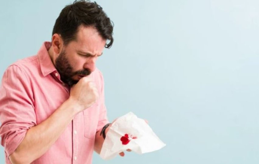 Kollitja me gjak: Kur duhet të shqetësohemi dhe si ta trajtojmë