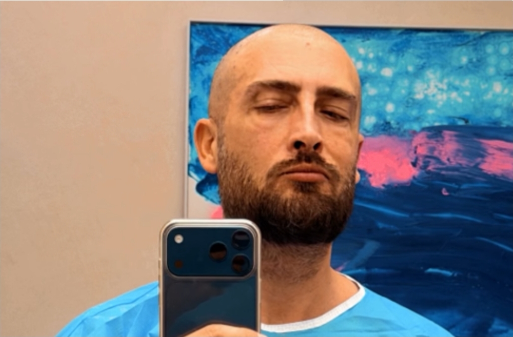 Alaudin Hamiti zbulon rrugën e re për pamjen e tij pas Big Brother VIP Kosova