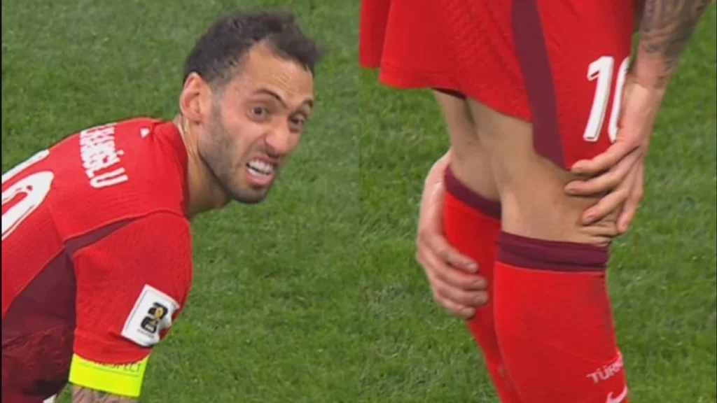 Calhanoglu pritet të mungojë në ndeshjen Turqi-Kosovë për shkak të dëmtimit në pulpë.