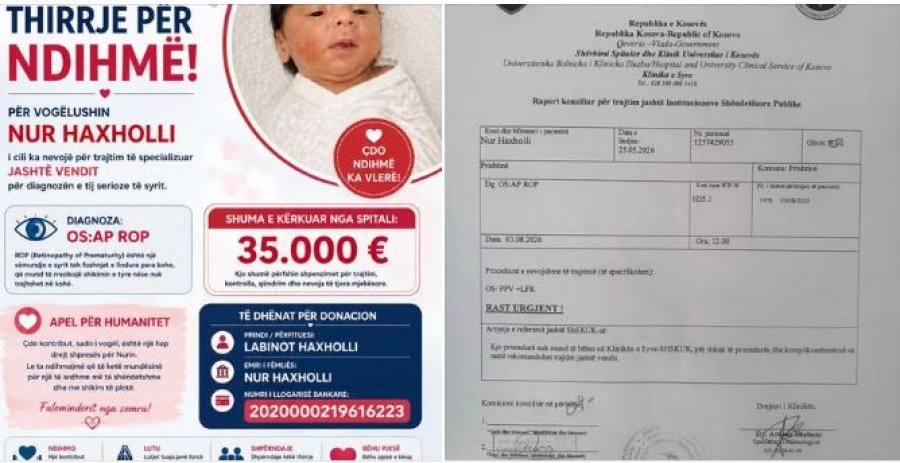 Shpresa për shikimin e vogëlushit Nur varet nga solidariteti ynë