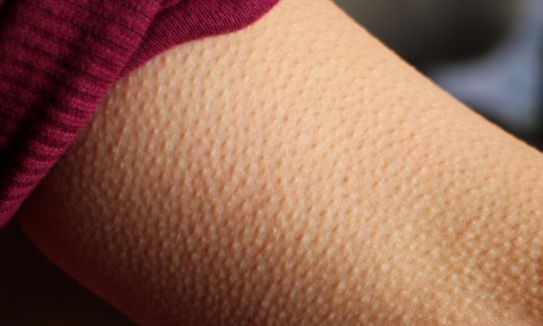 Si ndryshon truri i atyre që ndihen të rrëqethur nga muzika