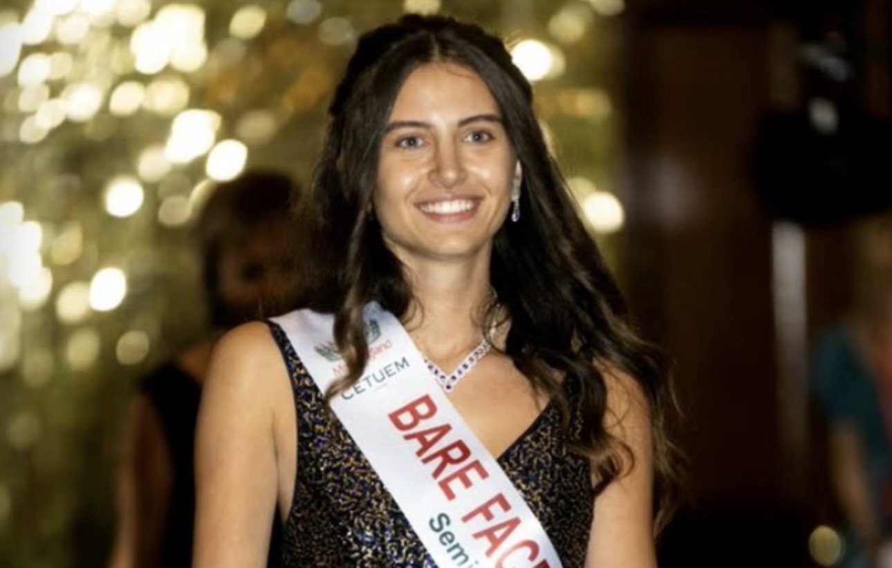 Melisa Raouf, finalistja që sfidoi bukurinë tradicionale pa grim