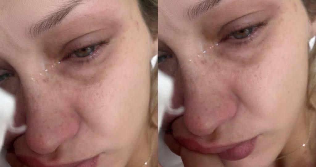 Bella Hadid përballet me përkeqësimin e sëmundjes së Lyme dhe ndan momentet e vështira