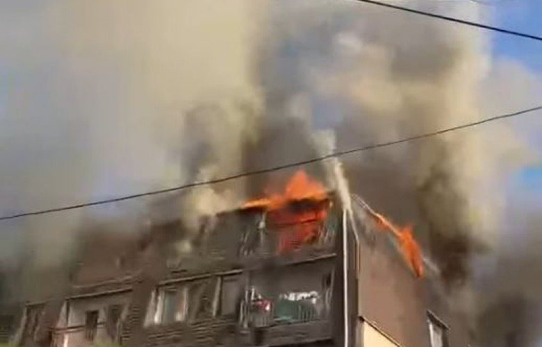 Gjendja stabile e 5-vjeçarit pas zjarrit pranë Parkut të Qytetit në Prishtinë